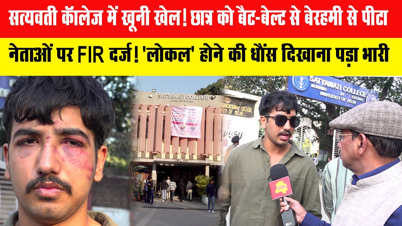 सत्यवती कॉलेज में खूनी खेल! छात्र को बैट-बेल्ट से बेरहमी से पीटा |