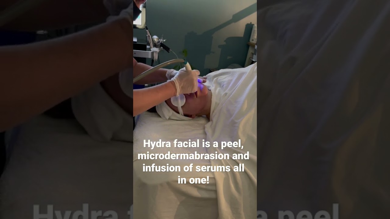 Try a Hydra facial at Radiant U Esthetics for a no downtime facial with immediate results!