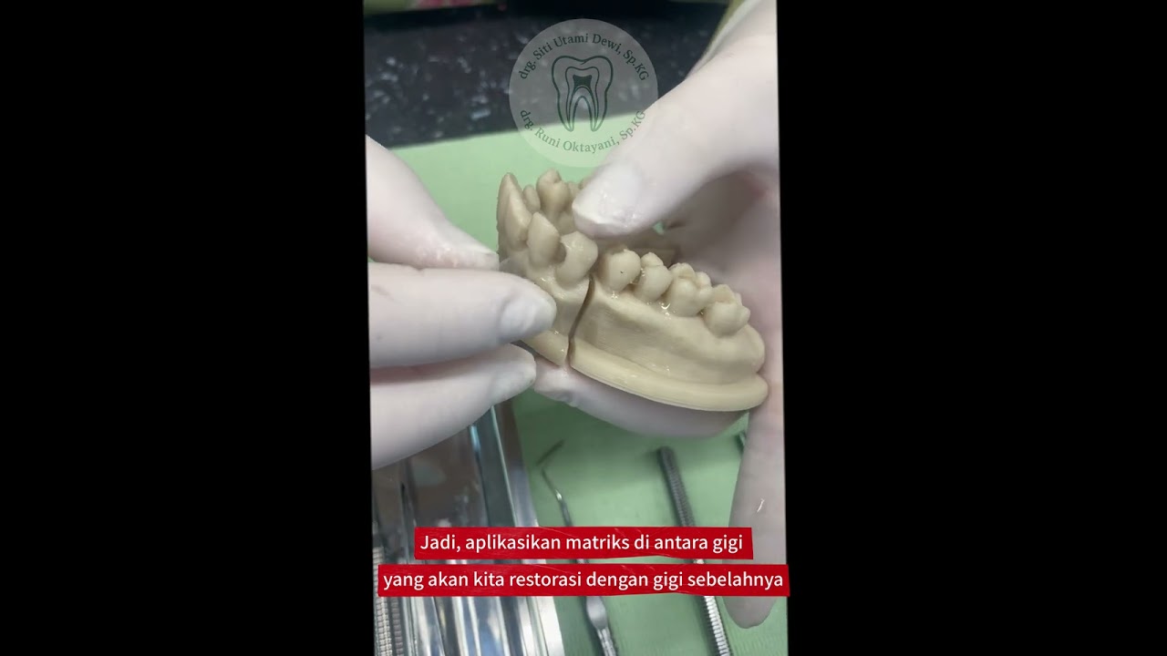 Restorasi Kelas 3 - Resin Komposit