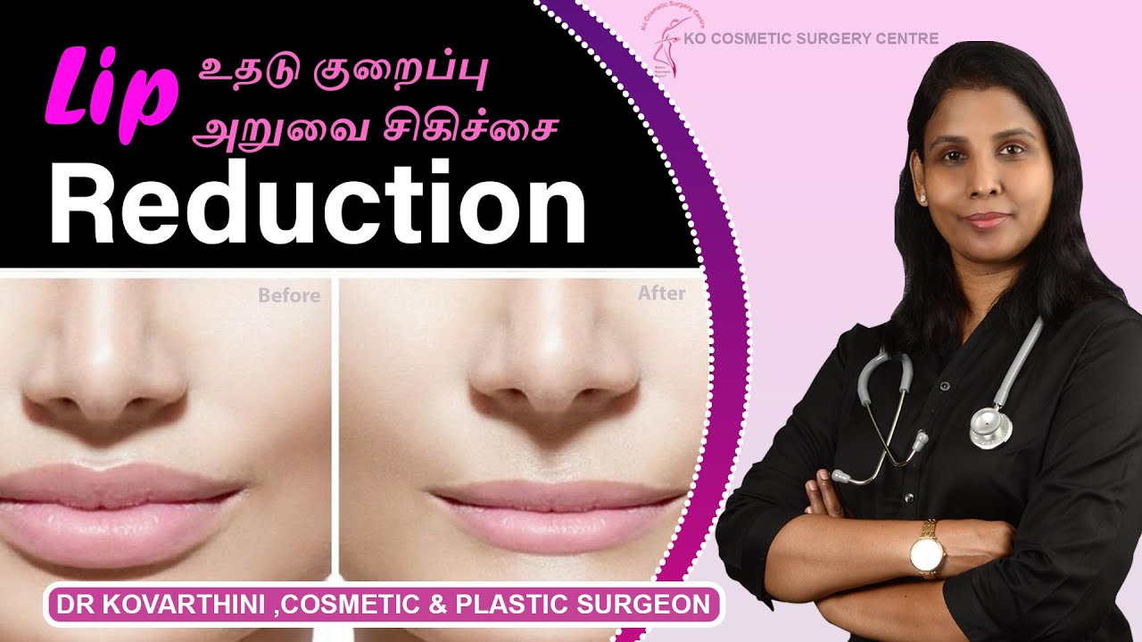 Lip Reduction Surgery in Tamil | உதடு குறைப்பு அறுவைசிகிச்சை | Dr. Kovarthini Cosmetic Surgeon