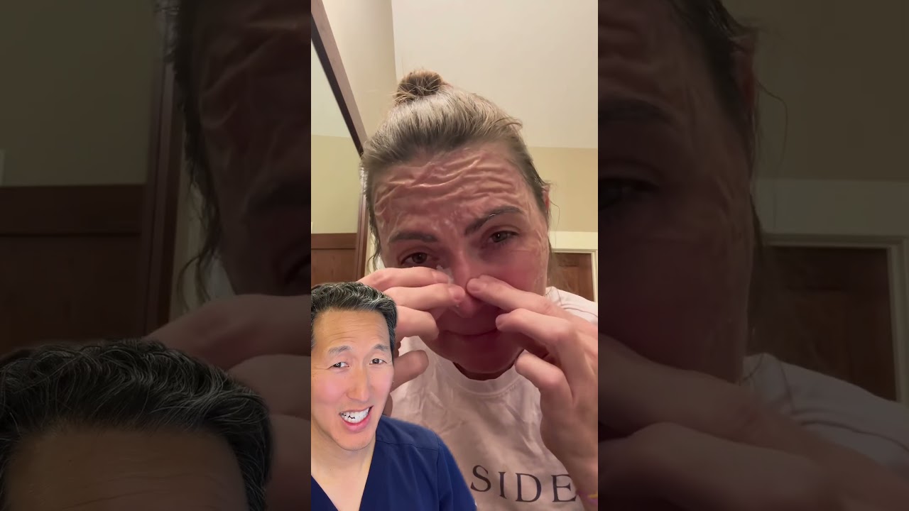 Plastic Surgeon Reacts to DIY Gelatin Face Mask!