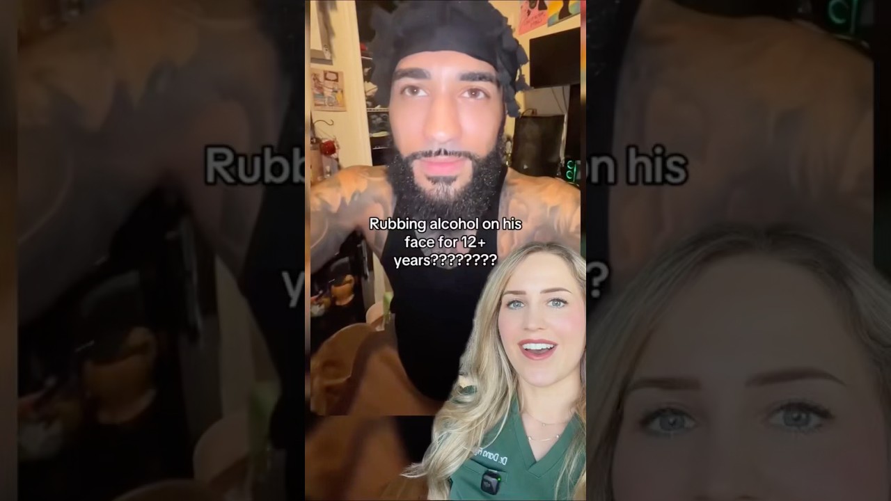 Did rubbing alcohol give him perfect skin?!