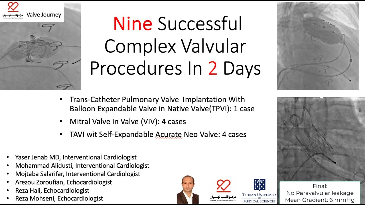 Nine Successful Complex Valvular Procedures In 2 Days: TPVI,TAVI and Mitral VIV