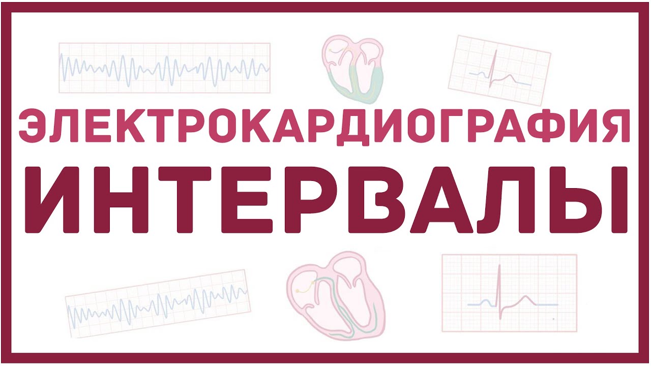 ЭКГ - интервалы