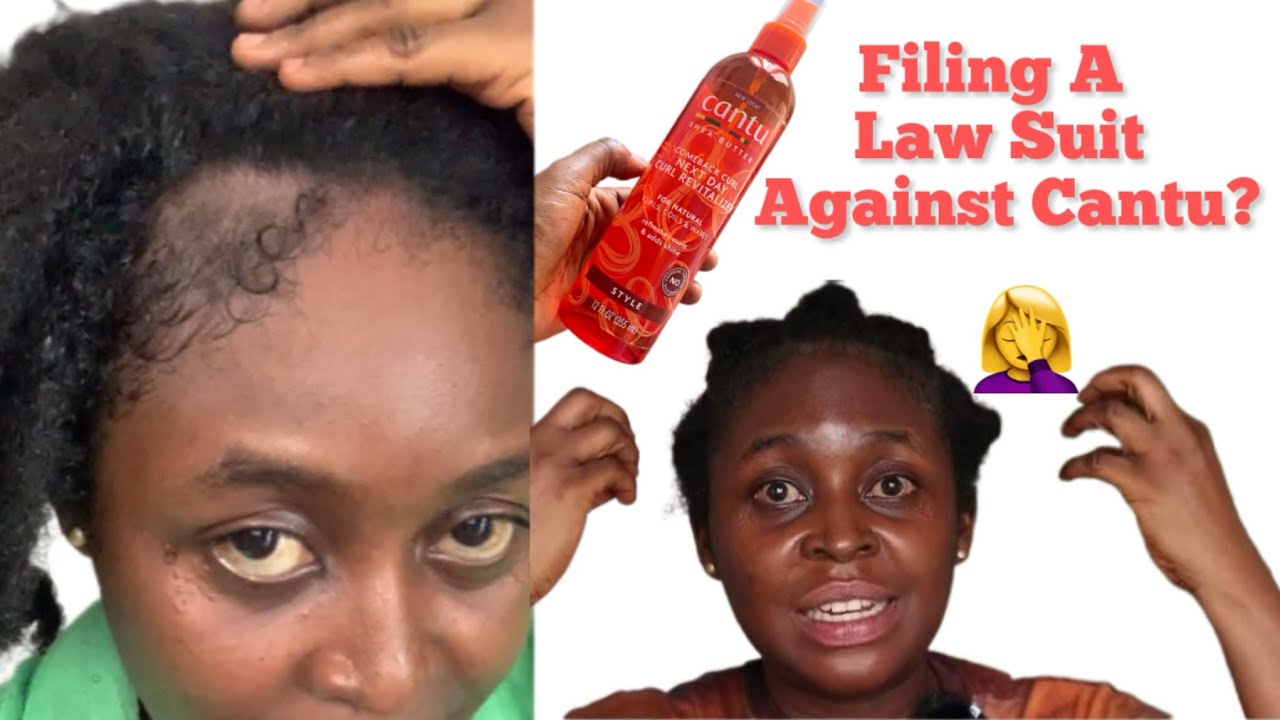 Filing A Law Suit ? Way Forward After My Hair Loss! What i will be Using to grow my hair back