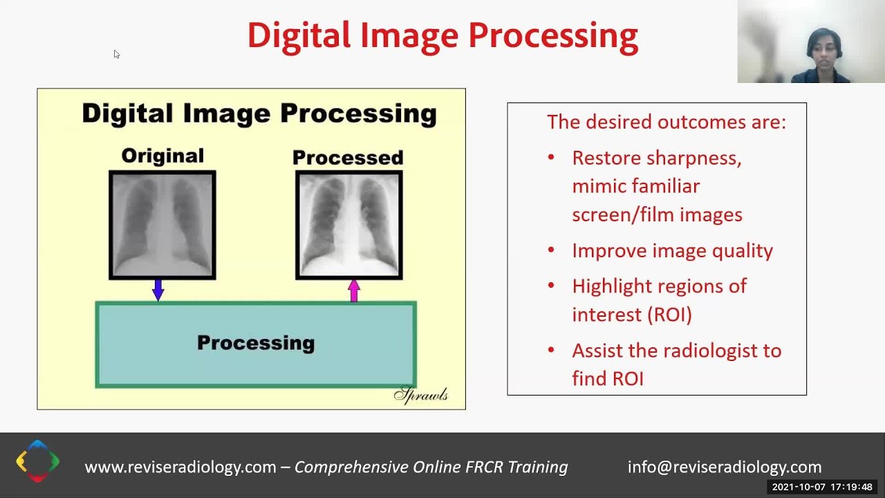 Multiple Imaging Modalities: Part 1 with Joanna Koshy