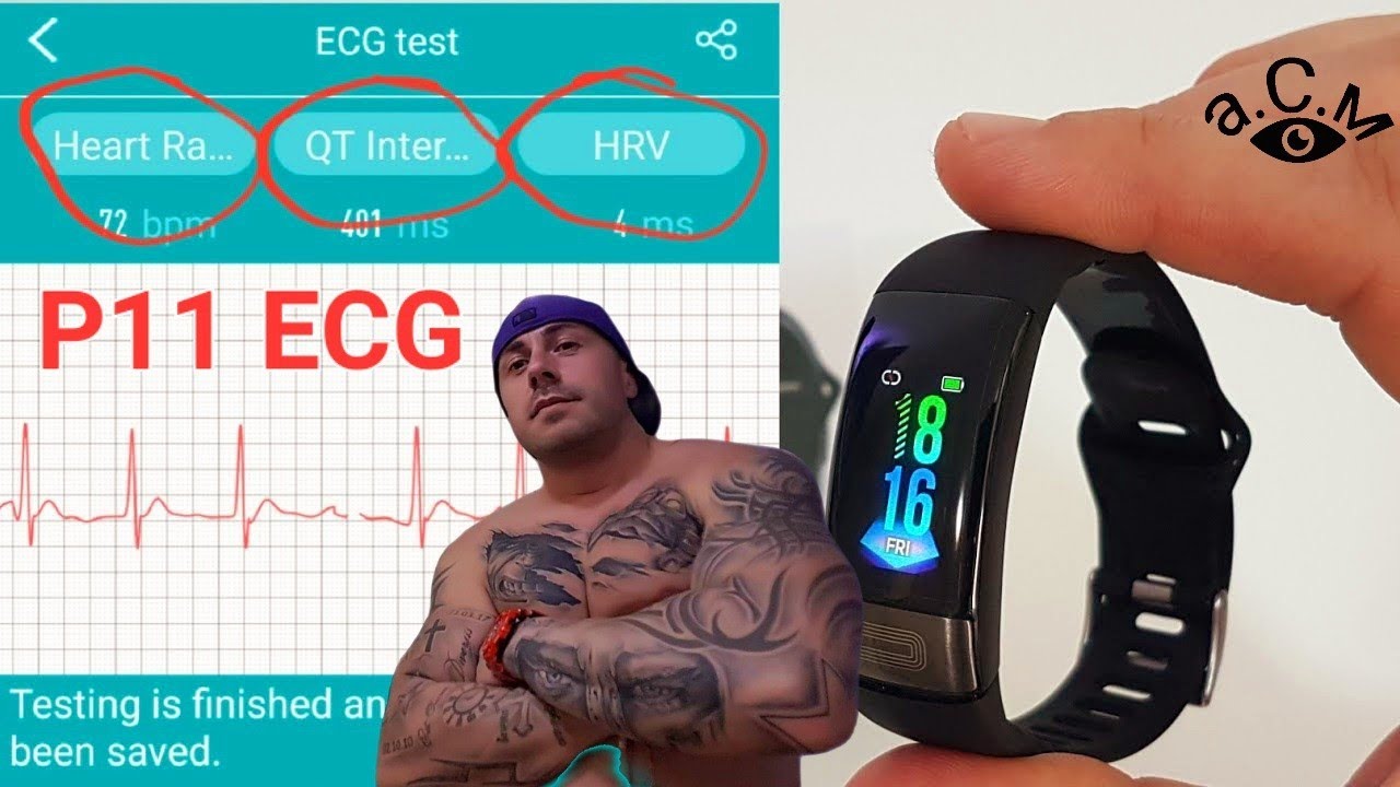 P11 ECG - H Band 2.0  а.С.м
