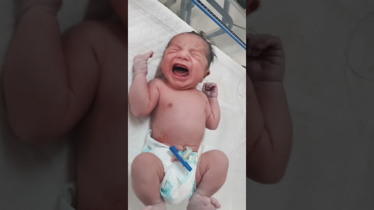 signs of good cry ,baby with APGAR score 8-10