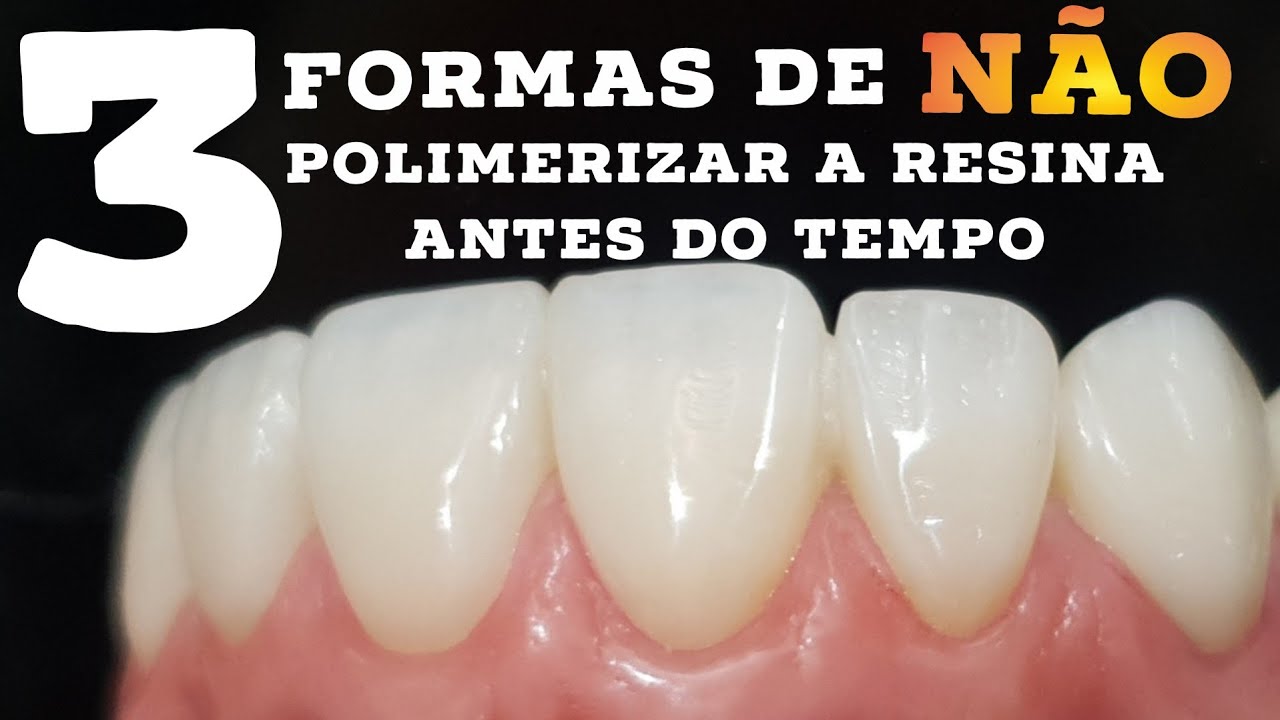 🔴3 FORMAS DE EVITAR A  POLIMERIZARIZAÇÃO DA RESINA ANTES DO TEMPO! 🤩🤩🤩🤩🤩