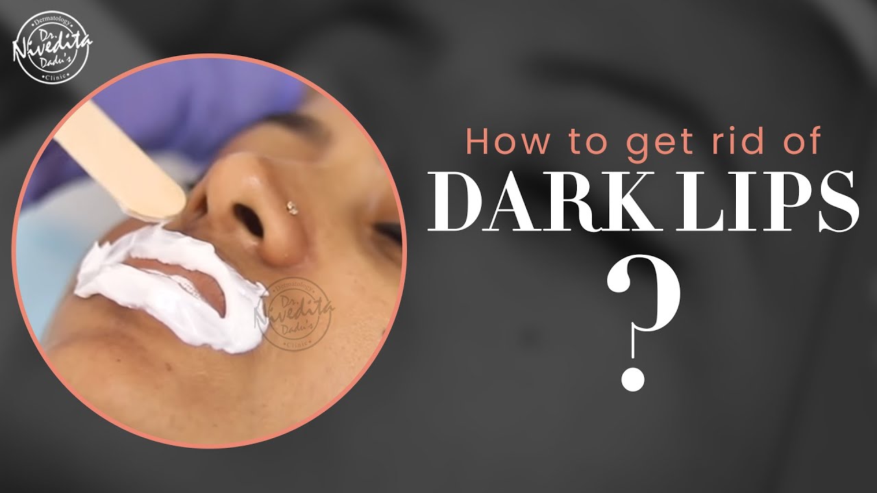 होठो का कालापन दूर करने का रामबाण इलाज | How to Lighten Dark Lips? | Dark Lips Treatment