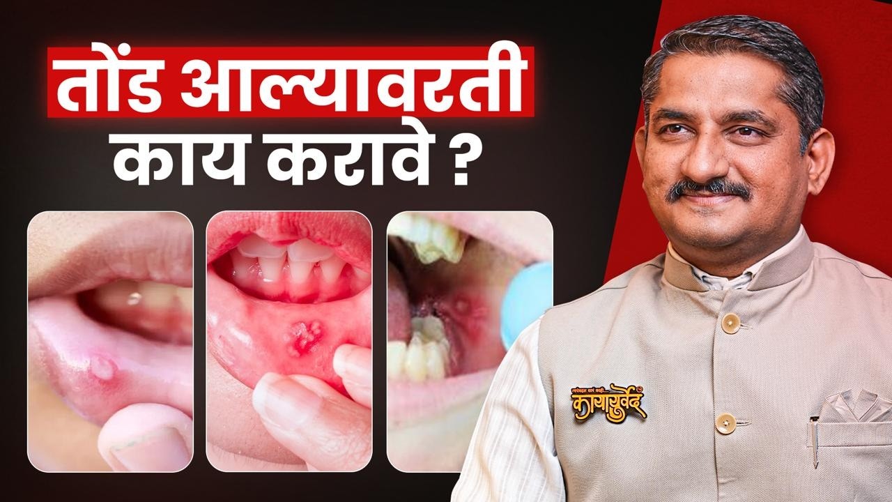 पोटातील उष्णता आणि तोंड येणे यावर घरगुती उपाय | Mouth Ulcers reason explained | Dr.Harish Patankar