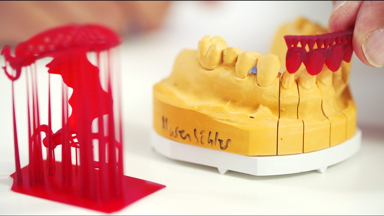 3D Druck im Dentallabor: Dentale Gusstechnik - digitale Herstellung von Casts mit Freeprint&reg; cast