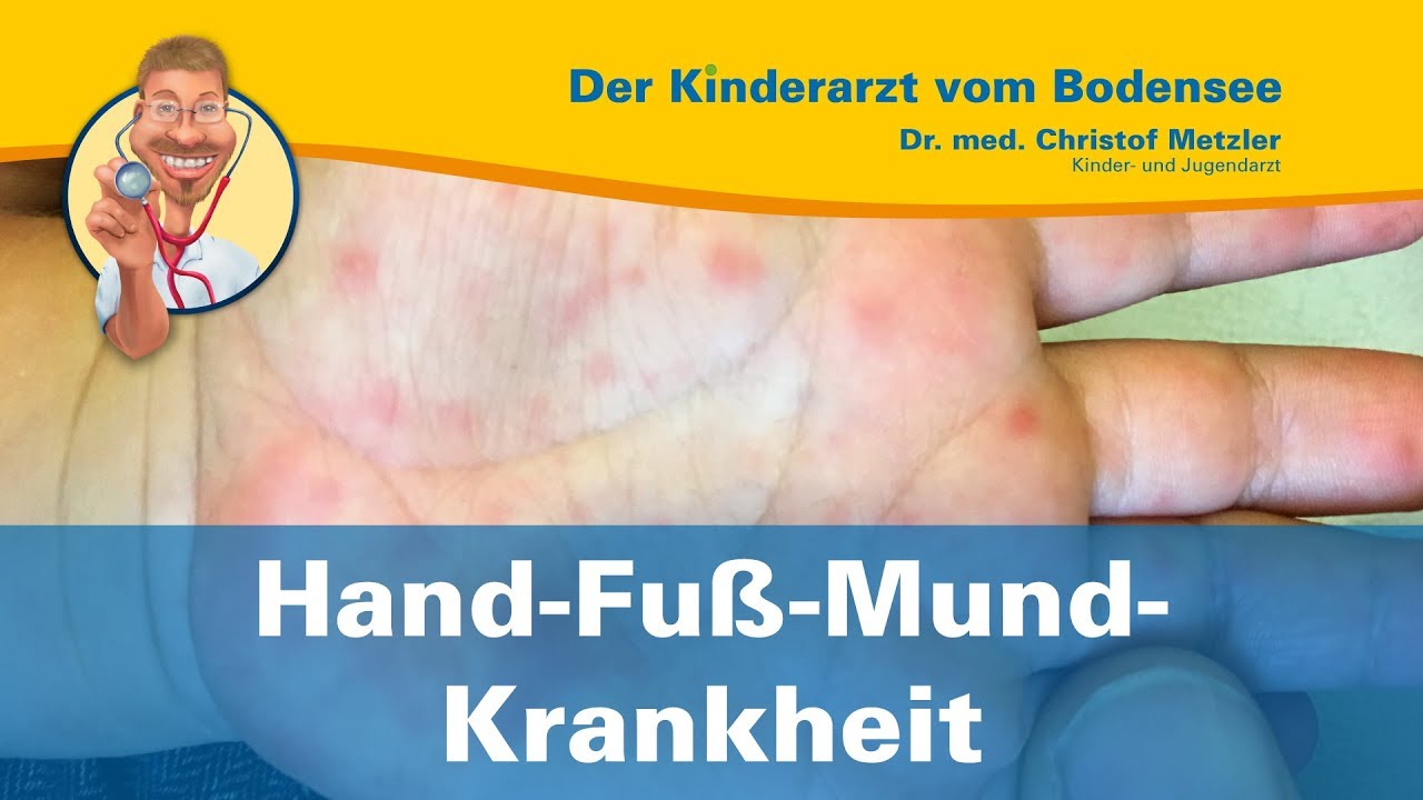 Hand-Fuß-Mund-Krankheit - Der Kinderarzt vom Bodensee