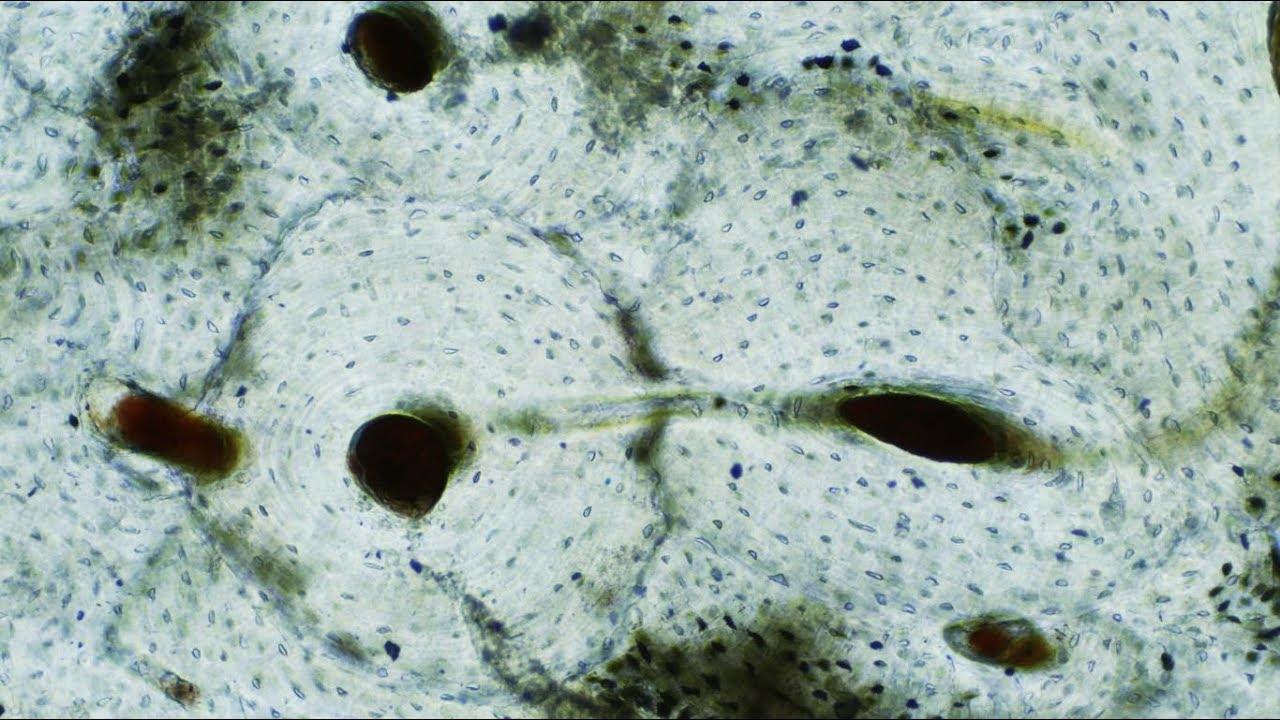 Histología del cartilago y hueso CAPÍTULO 5