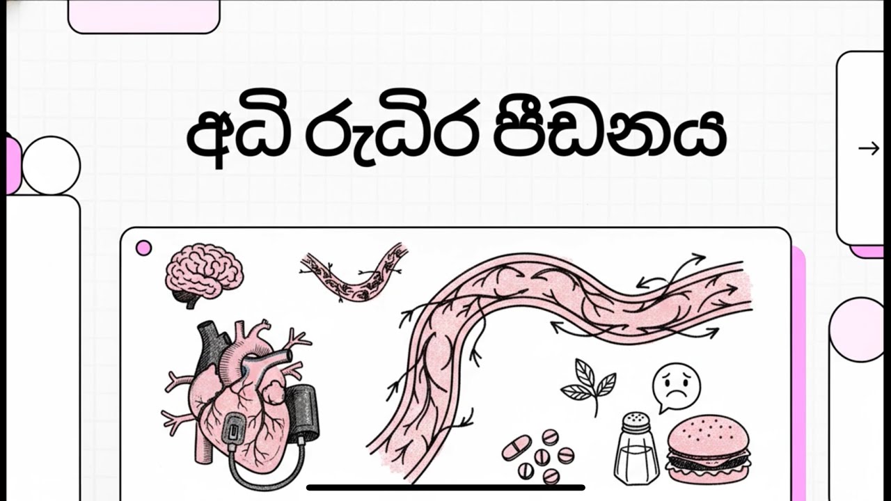 ජනාදිපතිටත් ප්‍රෙශ්‍රර් හැදෙන්න පුලුවන්ද ? | ප්‍රෙශර් වෙන්න එපා ප්‍රෙශර් වලින් | Hypertension 