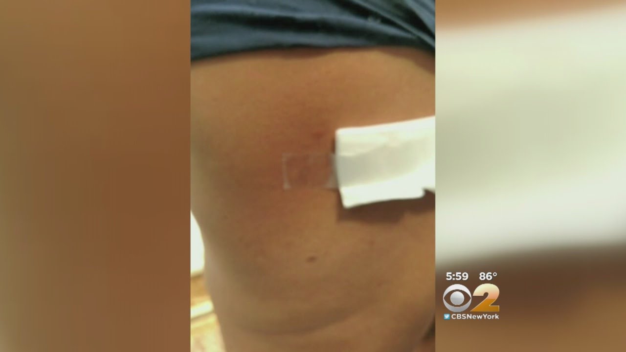 Exclusive: Pellet Gun Arrest