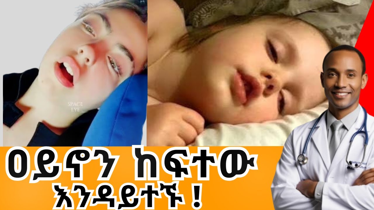 ዐይንን ከፍቶ መተኛት | የሚያመጣቸው ከባባድ ጉዳቶች 