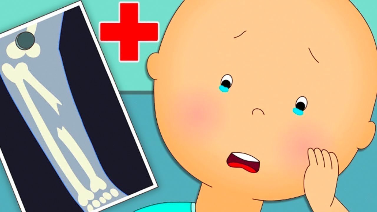 Caillou se rompe un hueso | Las Nuevas Aventuras de Caillou