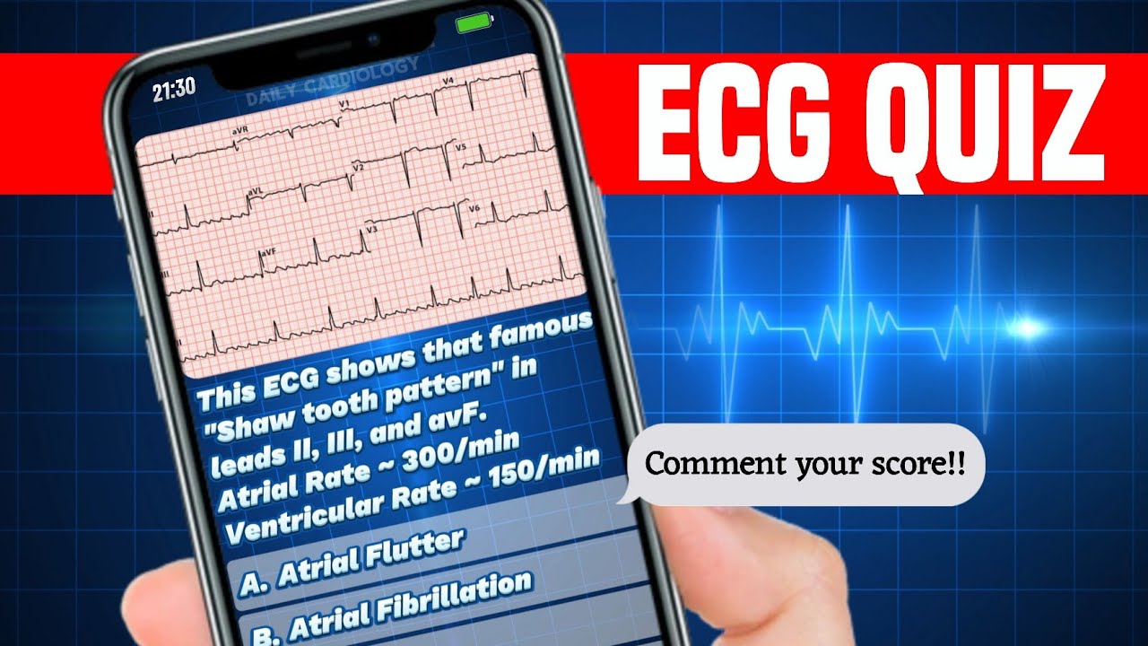 Тест по ЭКГ от Daily Cardiology | Станьте мастером ЭКГ