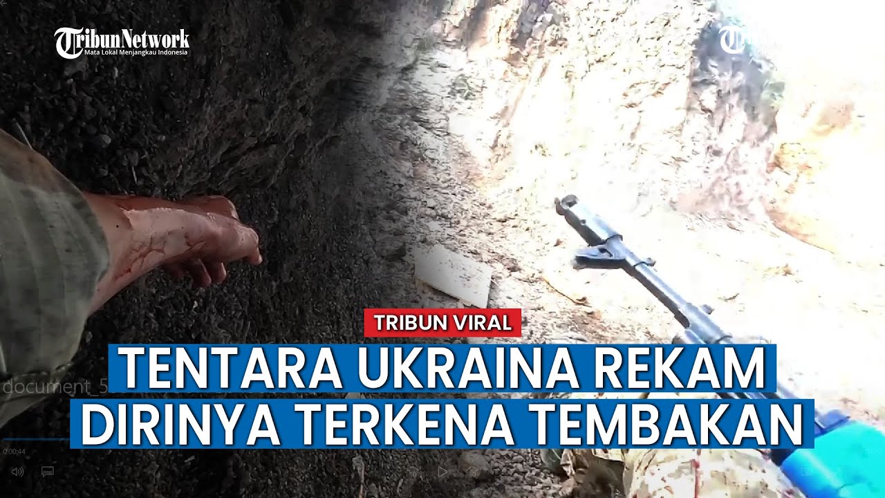 Tentara Ukraina Tiba-tiba Alami Luka, Kena Tembakan Rusia?