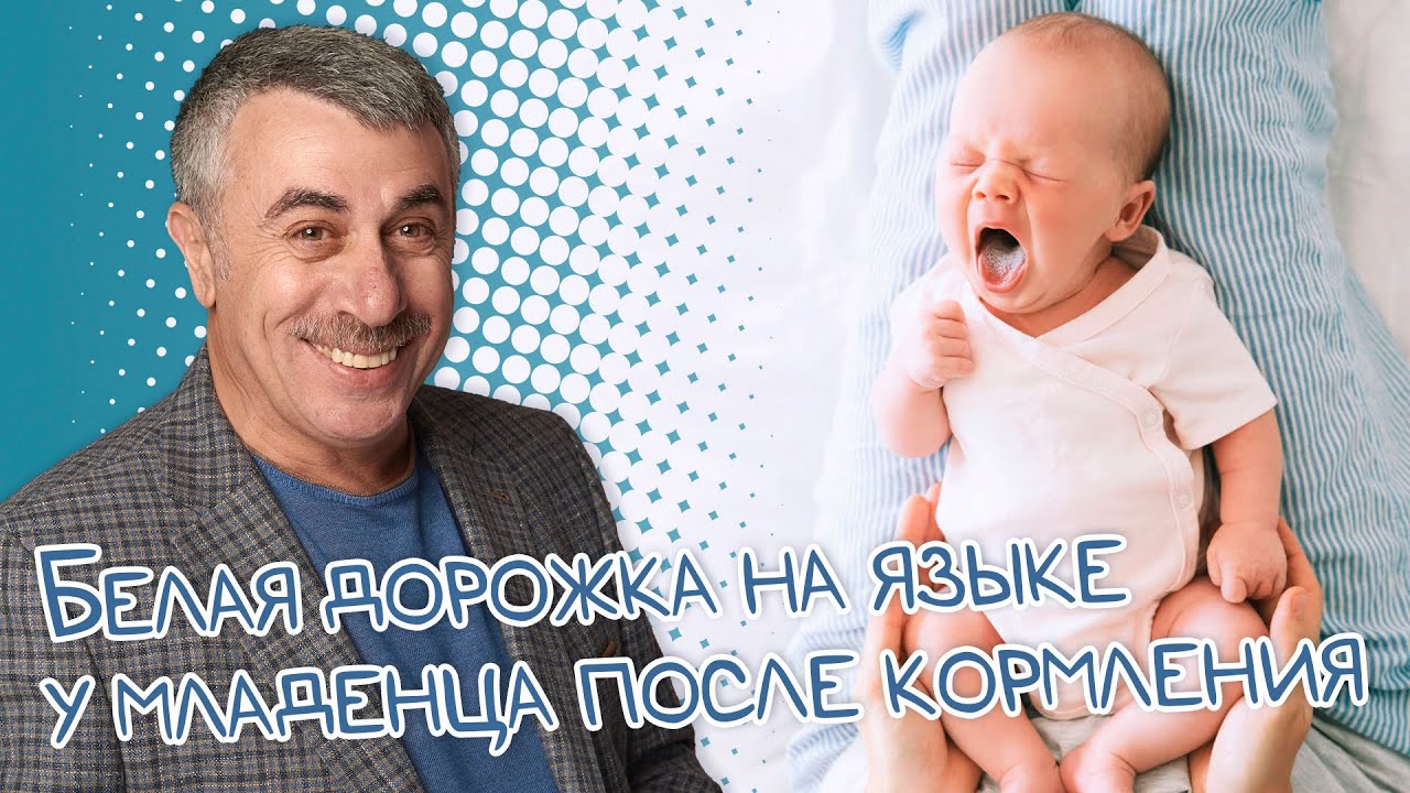 Белая дорожка на языке у младенца после кормления - Доктор Комаровский