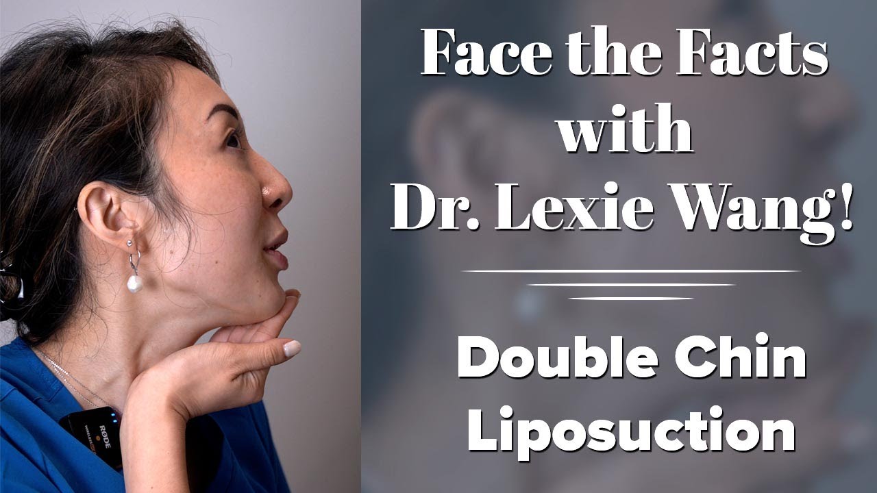 Lower Face & Neck (Submental) Liposuction - Face the Facts with Dr. Wang | West End Plastic Surgery