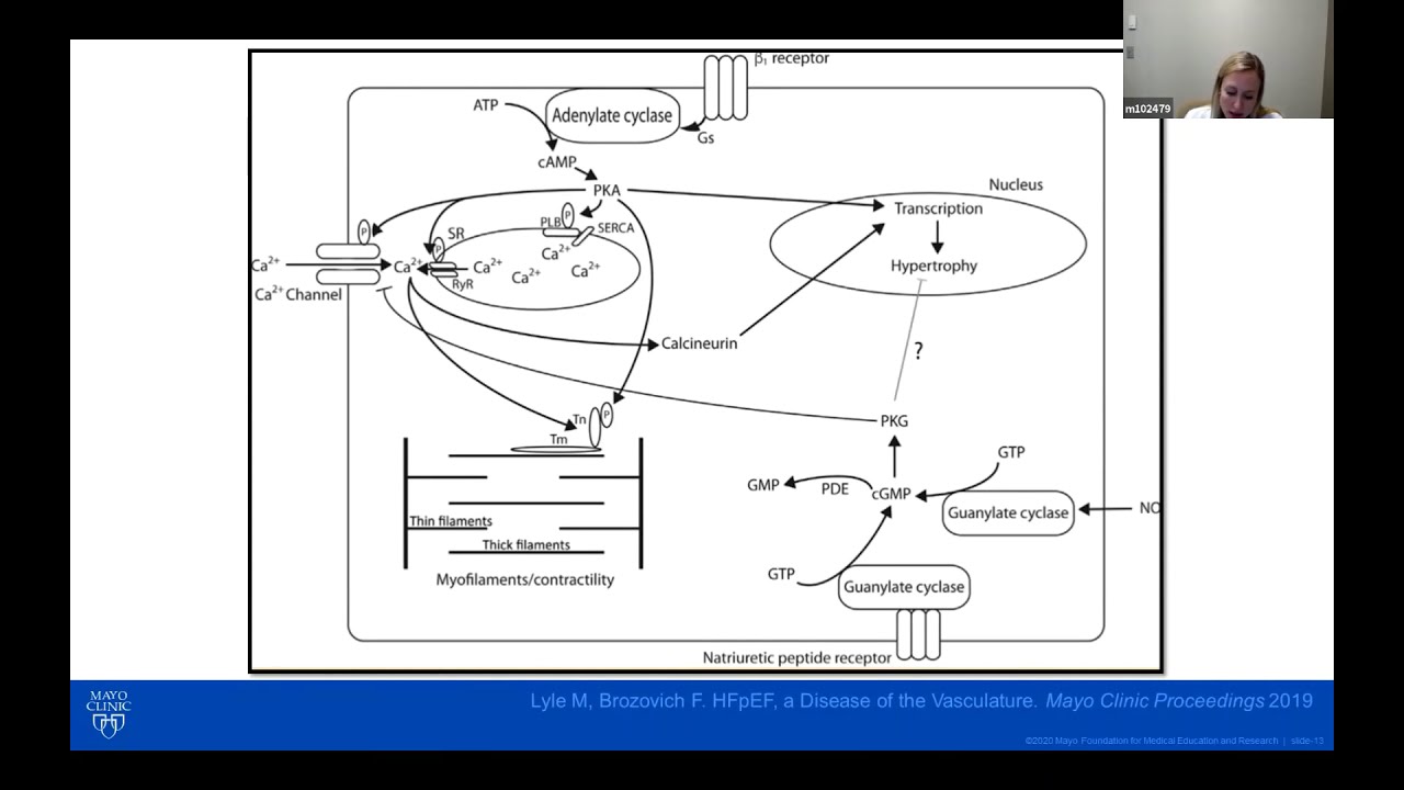 Heart Failure with Preserved Ejection Fraction, Mayo Clinic Webinar with Dr. Lyle