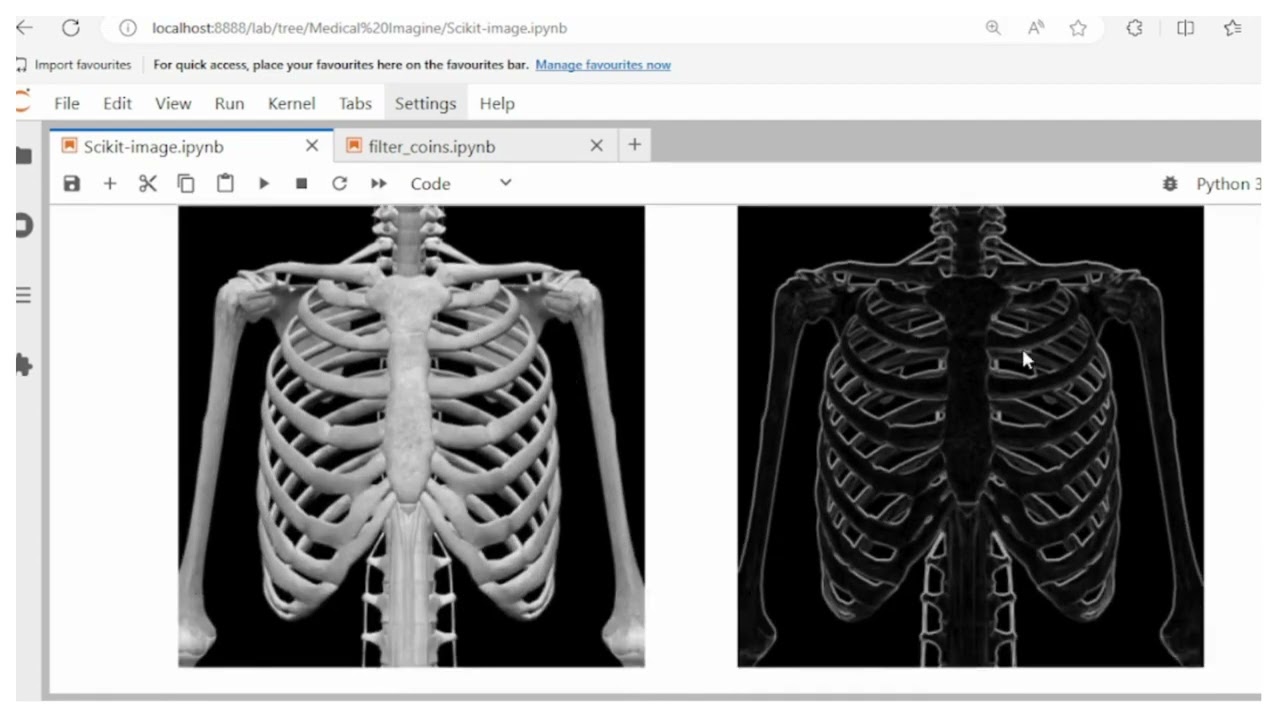 Medical Image Processing with Scikit Image library