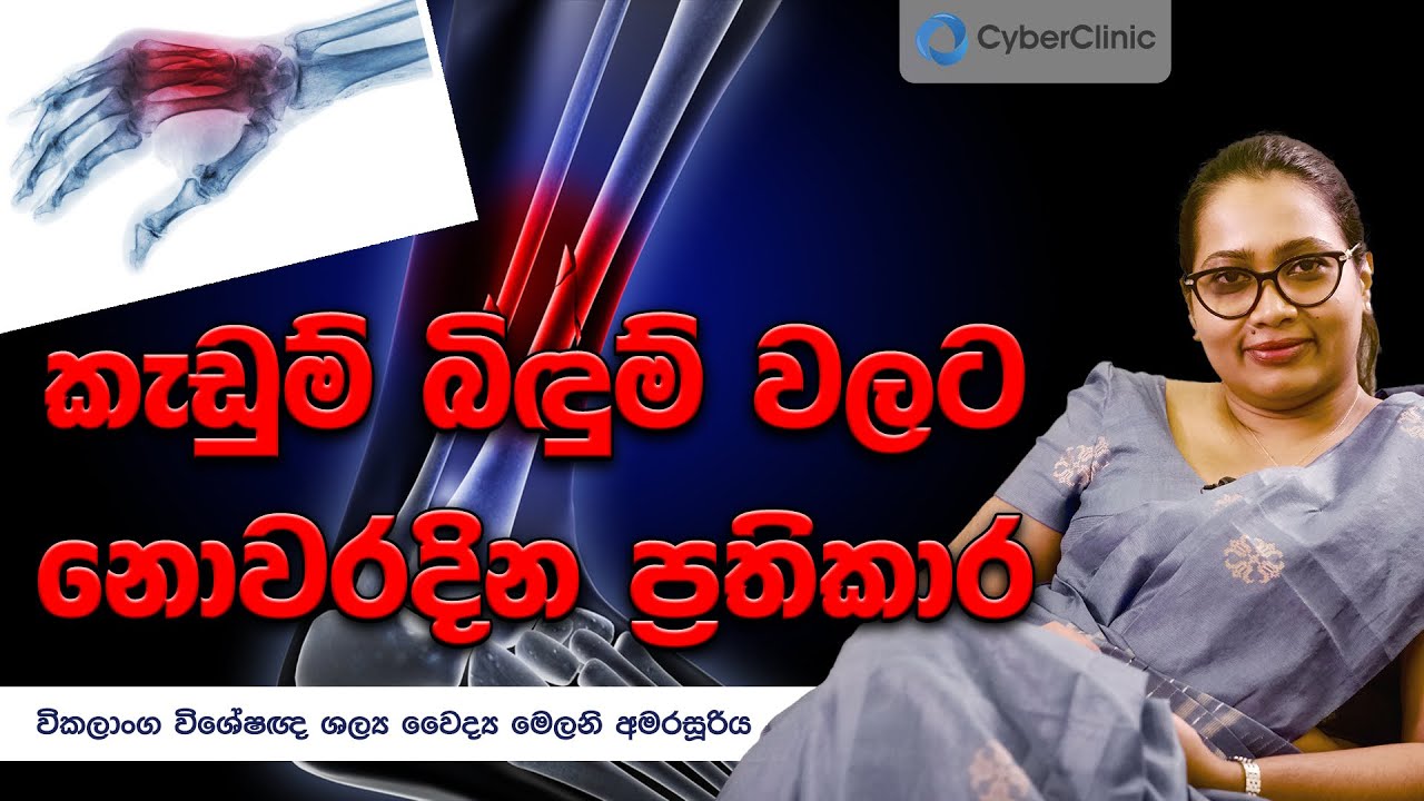 කැඩුම් බිඳුම් වලට නොවරදින ප්‍රතිකාර Cyber