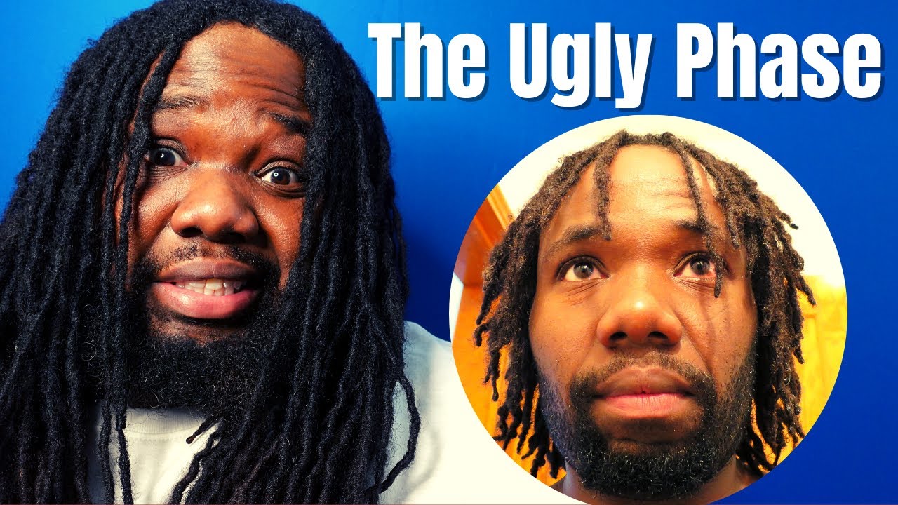 Surviving the Ugly Stage of Dreadlocks