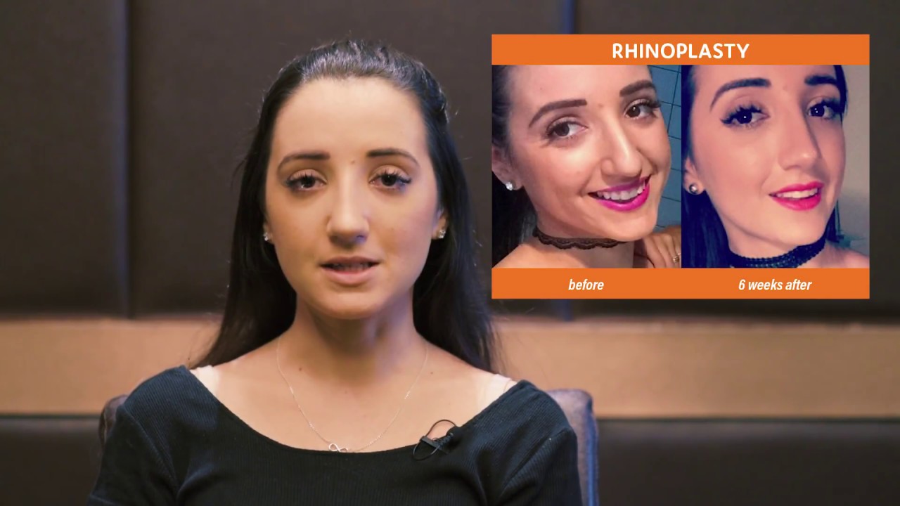 Rhinoplasty Transformation - CosMediTour Thailand