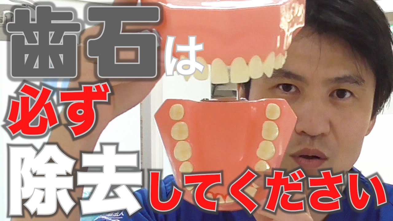 【歯石は必ずとるべき！】歯科医が教える「歯石」が引き起こす病気とストレス！