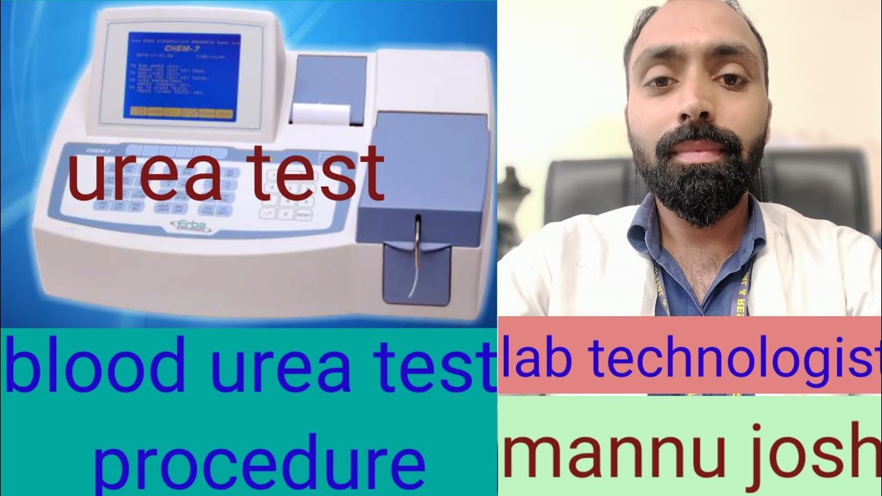 blood urea test procedure  / urea test in biochemistry / urea test manually