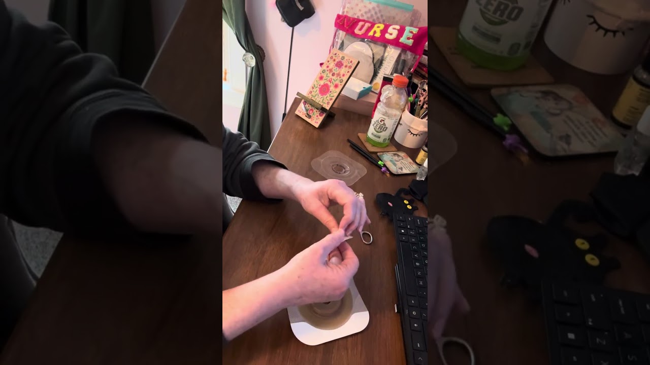 How to apply a barrier ring using an Eakin ring for ileostomy, urostomy