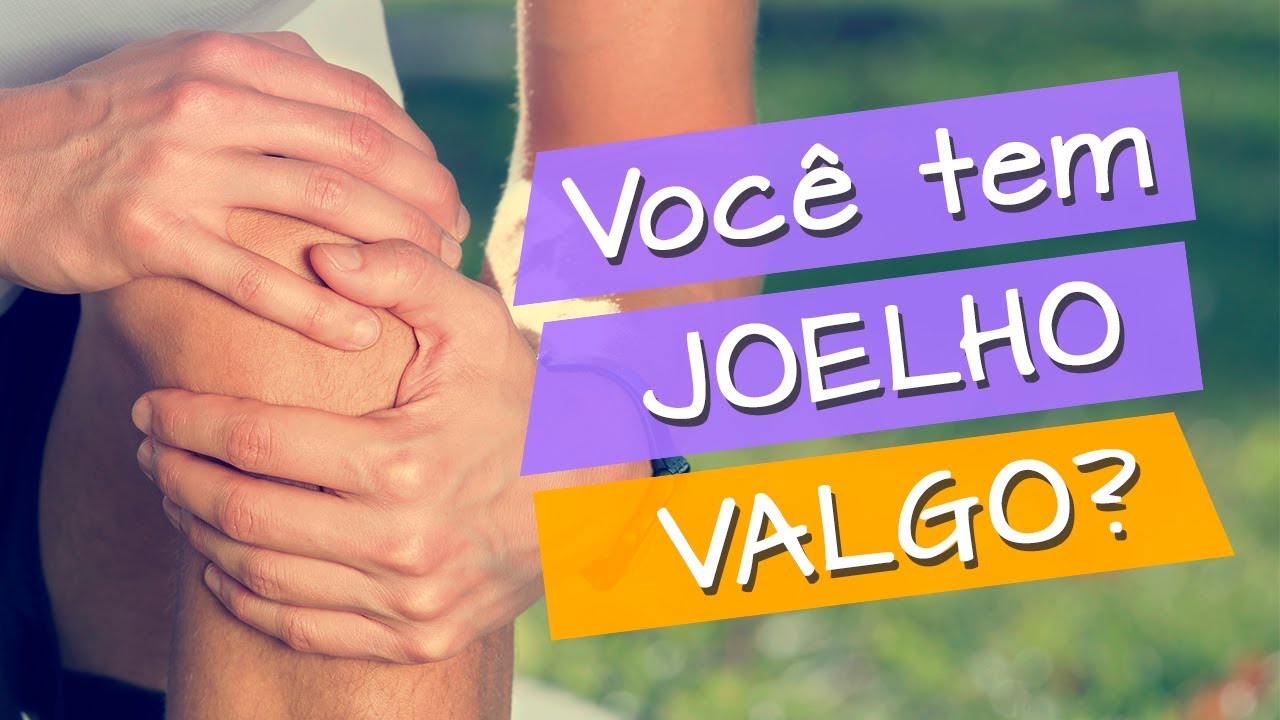 Causas e tratamento para JOELHO VALGO | Pés Sem Dor