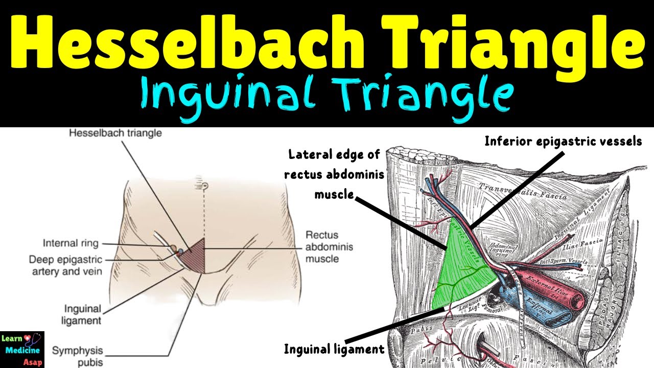 Hesselbach Triangle (Inguinal Triangle) &ndash; Location, Borders & Clinical Significance