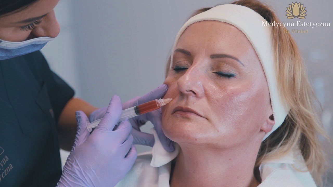 ODC 1 - Fibryna Bogatopłytkowa || Medycyna Estetyczna Dr. Karolina Winkel