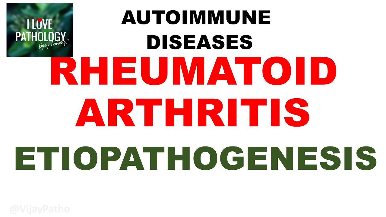 RHEUMATOID ARTHRITIS | PATHOGENESIS