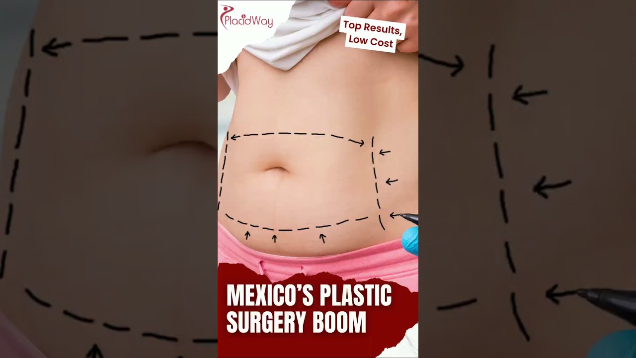 Plastic Surgery in Mexico: Why Americans Are Doing It!