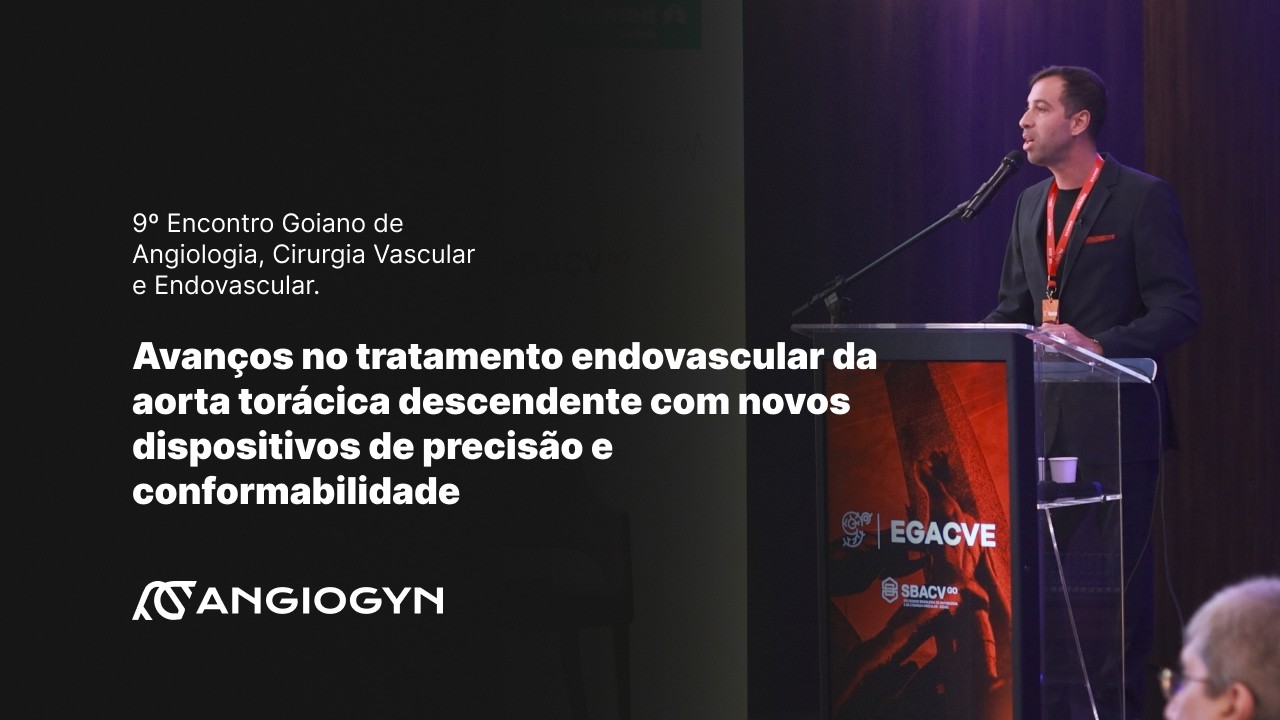Avanços no tratamento endovascular da aorta torácica descendente com novos dispositivos