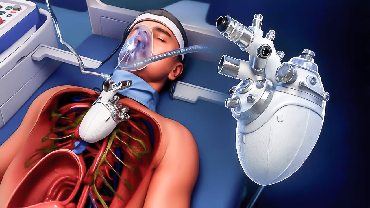 Fully Implantable Artificial Heart | Surgeon Reacts