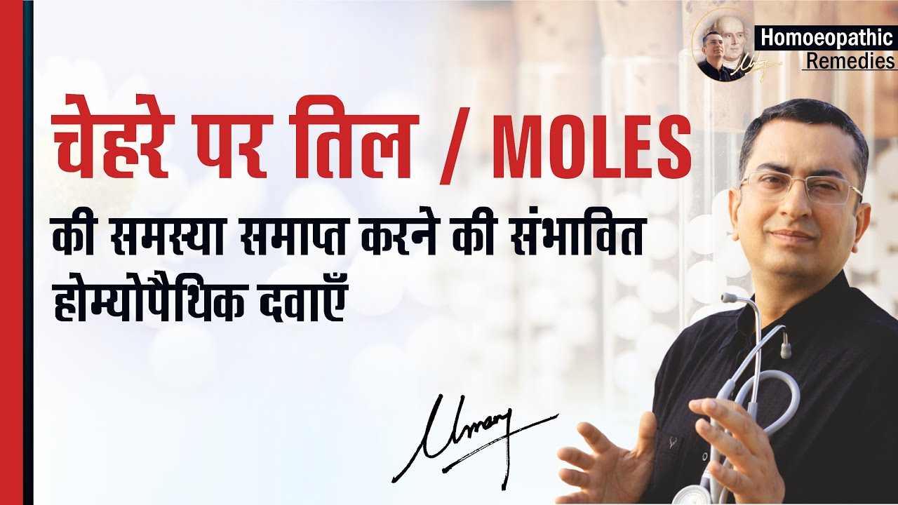 चेहरे पर तिल || Moles || Natural Homeopathic remedies || होम्योपैथिक उपचार