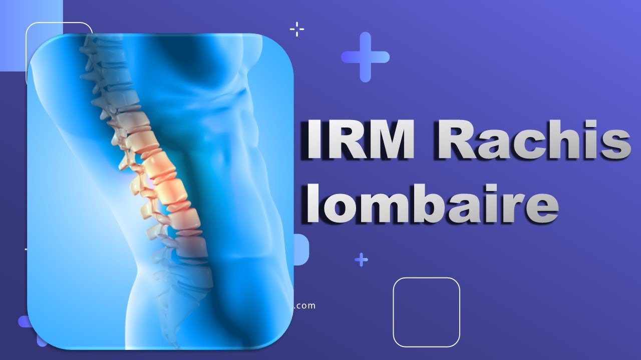 IRM du Rachis lombaire -Bonne Pratique_