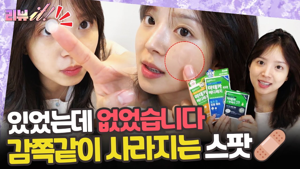 제약사 제조로 신뢰도 UP 단계별 관리가 가능한 스팟 패치 🩹 [리뷰잇 1회]