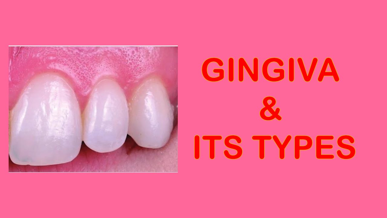 Types of Gingiva & Their Importance in Oral Health