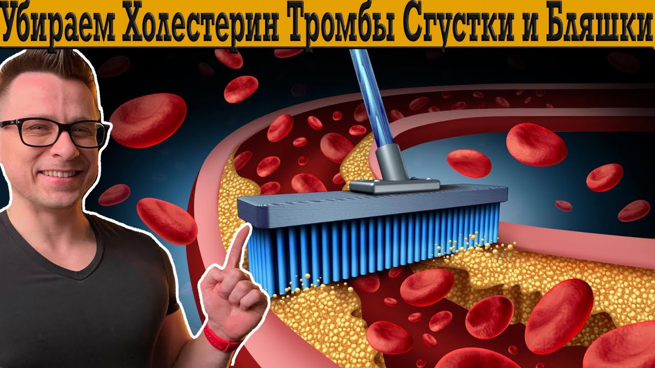 Убираем Холестерин, Бляшки, Сгустки и Тромбы! Здоровое сердце и сосуды!