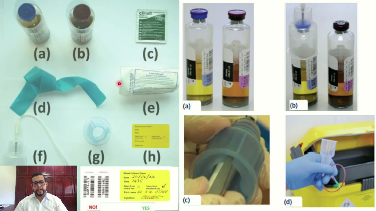 9  Infecciones Bacterianas en Sangre Bacteremia
