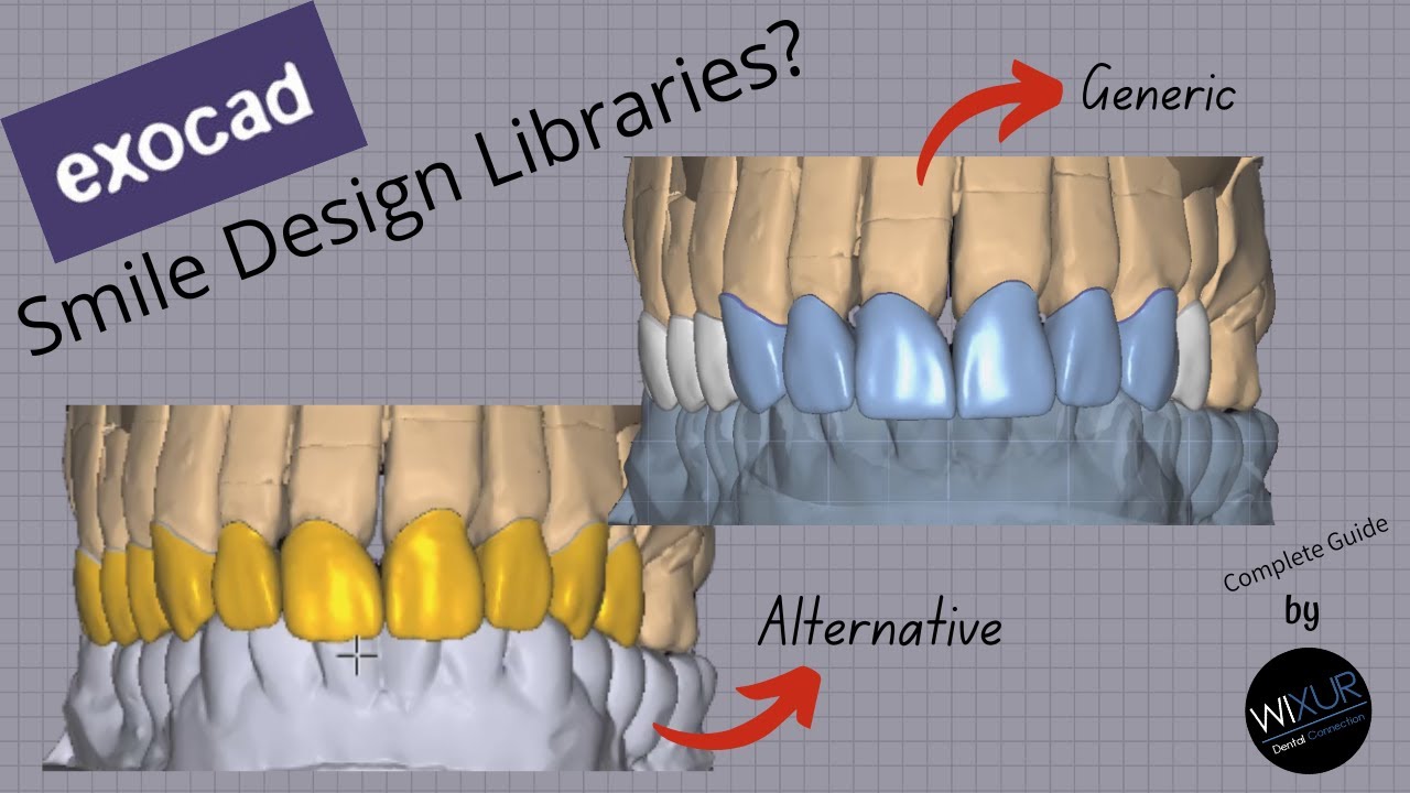 Smile Design Libraries Part 1