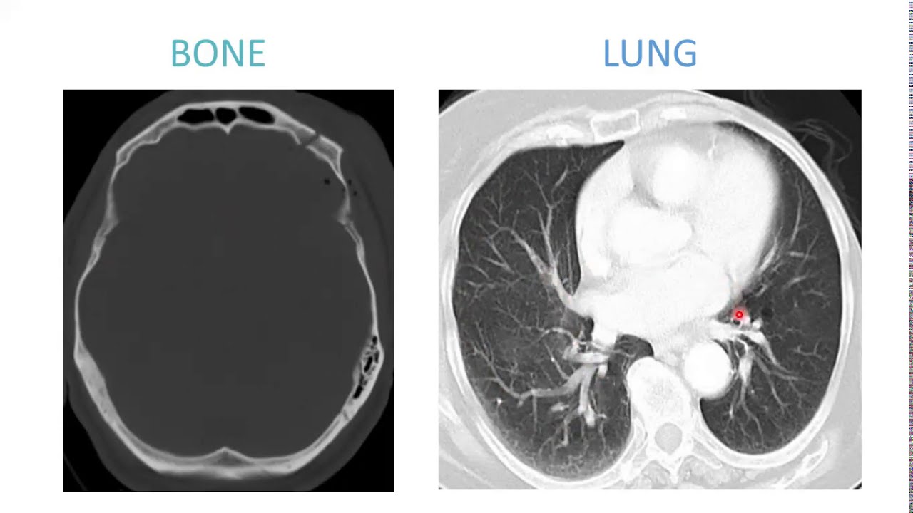Introdução os estudo anatômico por imagens de Tomografia