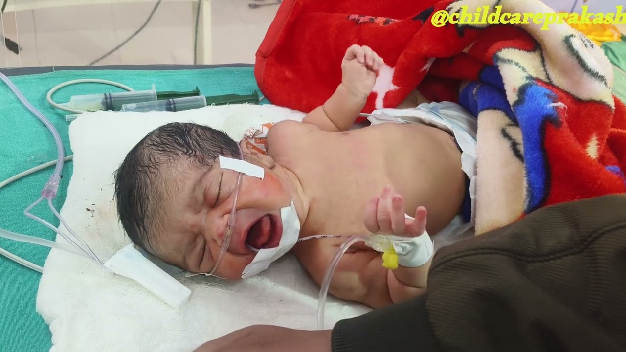 Delay Cry Baby After Birth|Admitted in NICU| 